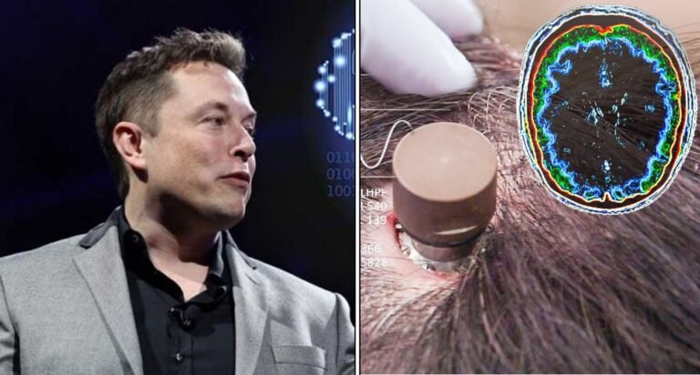 Elon Musk’s bid to implant chips into human brains shot down by feds